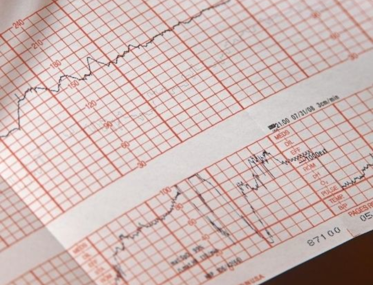 Karta wypadku - kto wypełnia i co warto wiedzieć?