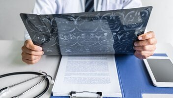 Co to jest gruczolak przysadki mózgowej i jak się go leczy?