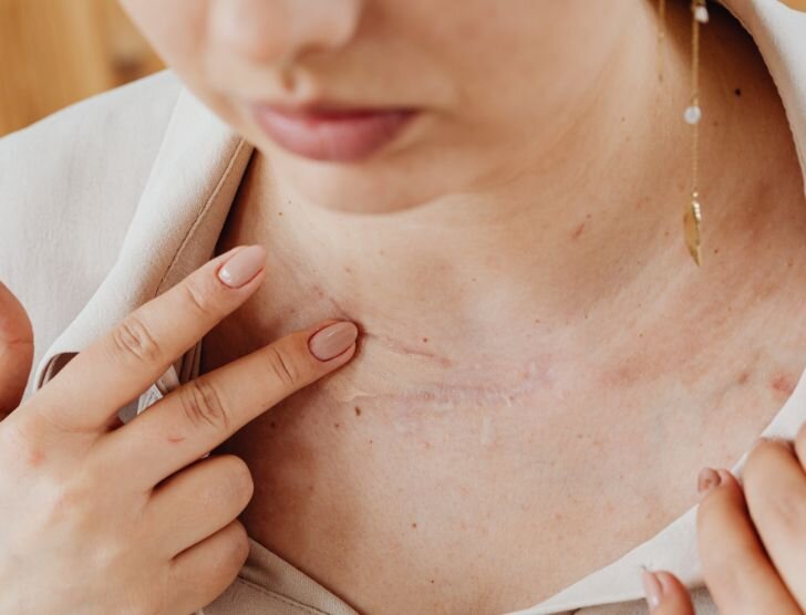 Czy za blizny należy się odszkodowanie?