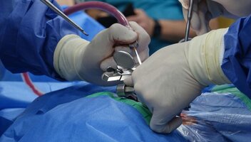 Złamanie kręgosłupa – diagnostyka, leczenie i rehabilitacja
