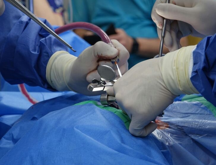 Złamanie kręgosłupa – diagnostyka, leczenie i rehabilitacja