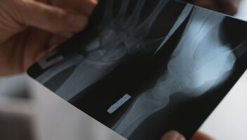 Ubezpieczenie na wypadek niezdolności do pracy – kiedy warto je mieć?